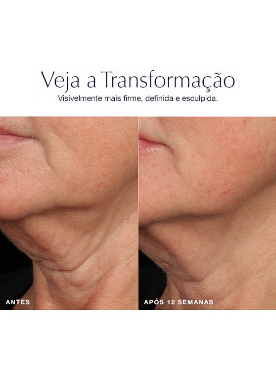 Sérum Lift e Firmeza Revitalizing Supreme