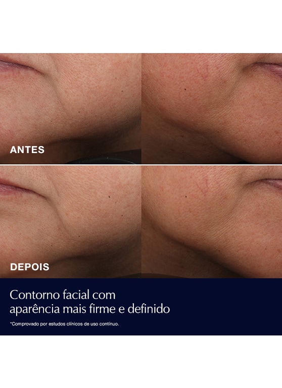 Hidratante Antirrugas Revitalizing Supreme+ Pele Seca